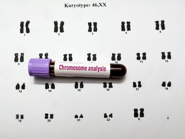 Blood sample isolated with patient report for karyotyping test, study for abnormal chromosome.