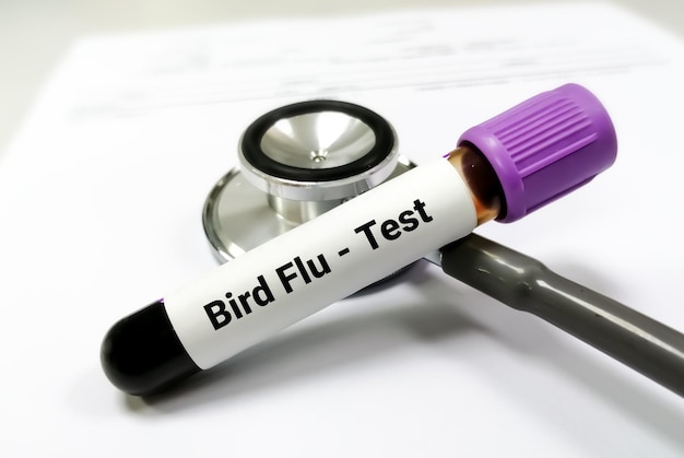 Blood sample isolated with stethoscope for Bird Flu test.