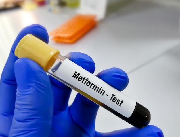 Blood sample for Metformin drug level test to set therapeutic range for diabetic patient