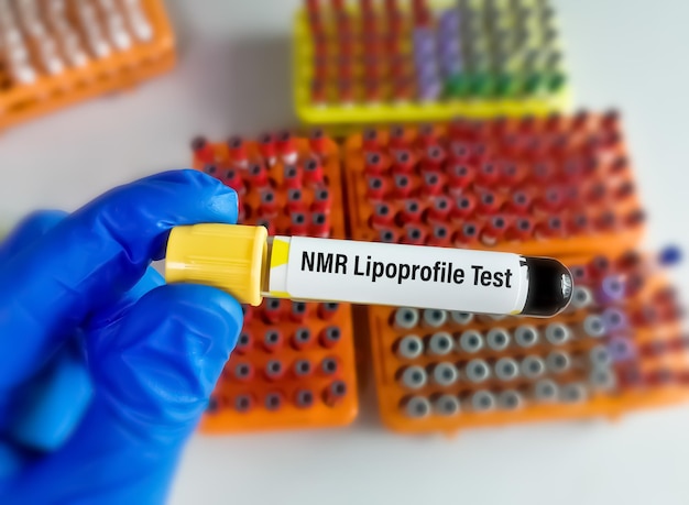 Blood sample for NMR Lipoprofile test.