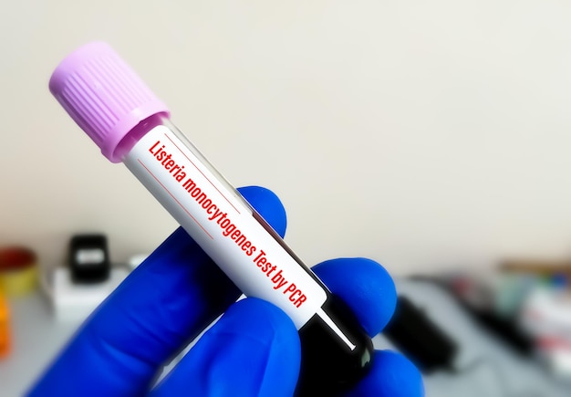 Blood sample for PCR detection of Listeria monocytogenes. Listeriosis.