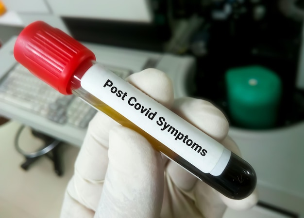 Blood sample for Post Covid Symptom testing