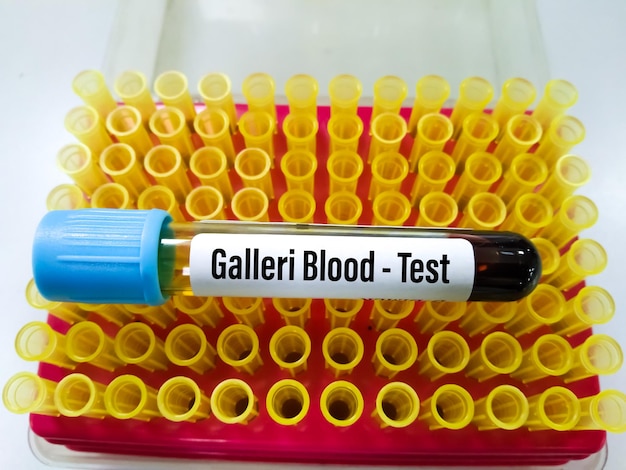 Blood sample tube for Galleri blood test for the early diagnosis of multi-cancer.