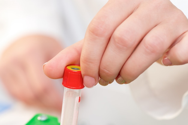 Blood sample tubes in hands.