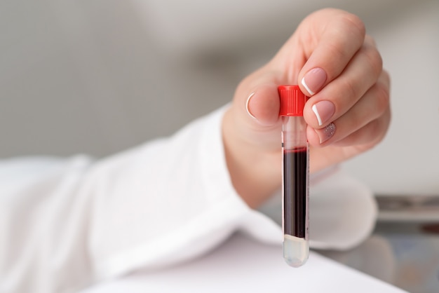 Blood sample tubes in hands