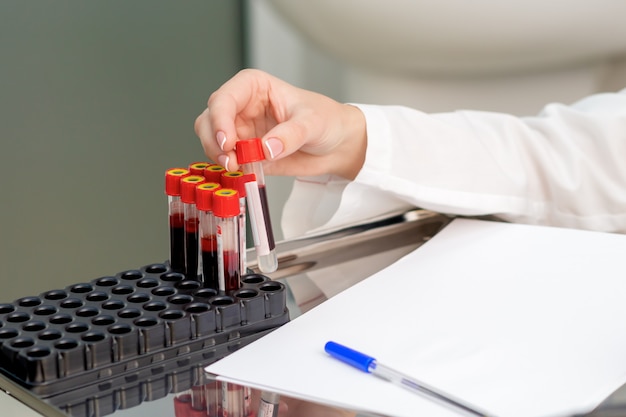 Blood sample tubes in hands