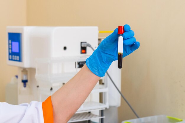 Blood samples for research in microtubes Hand in latex glove holds blood sample Selective focus