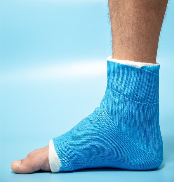 Blue splint ankle. Bandaged leg cast on male patient. Sports injury concept.