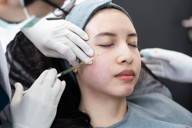 Botox, Filler injection for Asian female face