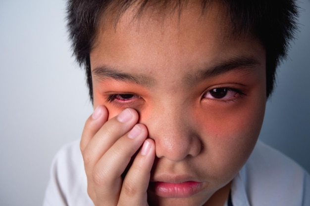 The boy pains his eyes He presses his eye by fingers This shot is close up portrait At red color it shows position of symptoms