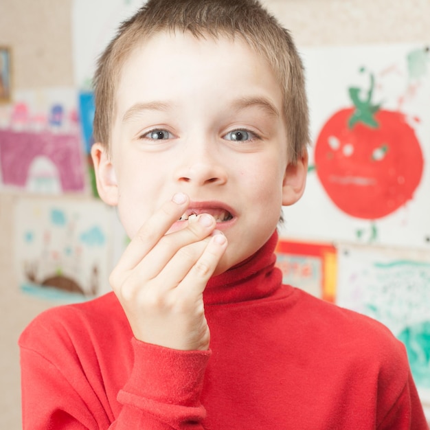 Boy with lost teeth