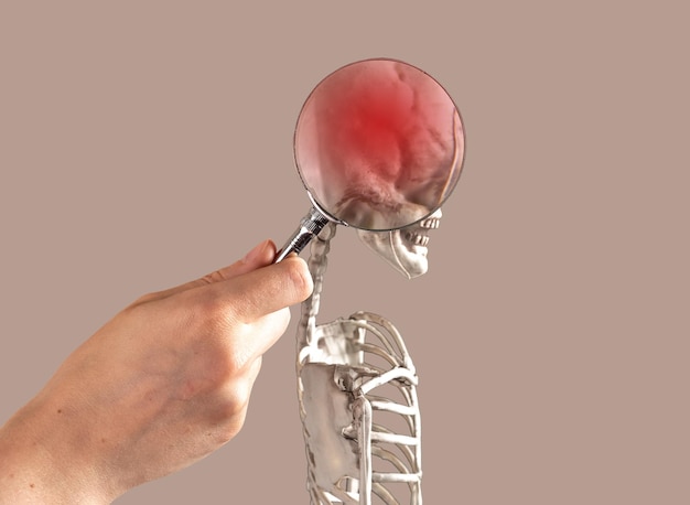 Brain disease concept Skull injury stroke concussion