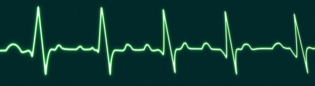 Photo bright green heartbeat line icon isolated on blue grid background