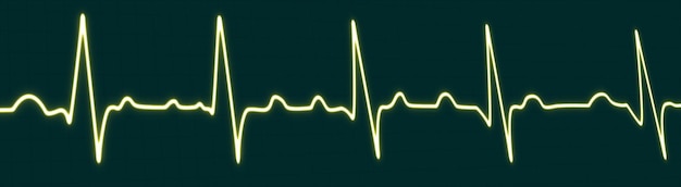 Photo bright yellow neon heartbeat line icon isolated heartbeat line pulse trace ecg or ekg