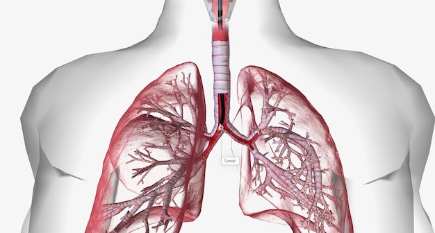 Photo bronchoscope discovery can detect tumors signs of infection excessive mucus blockages in the lungs and airways