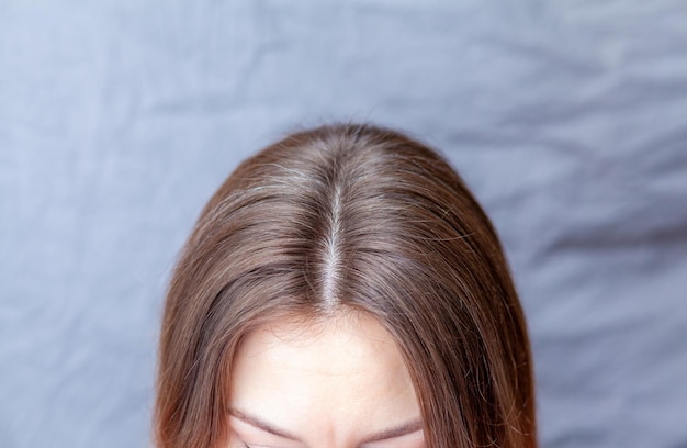 Brown hair on a woman's head closeup Hair regrowth