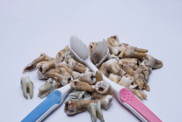 the bundle of unwanted extracted decay human teeth