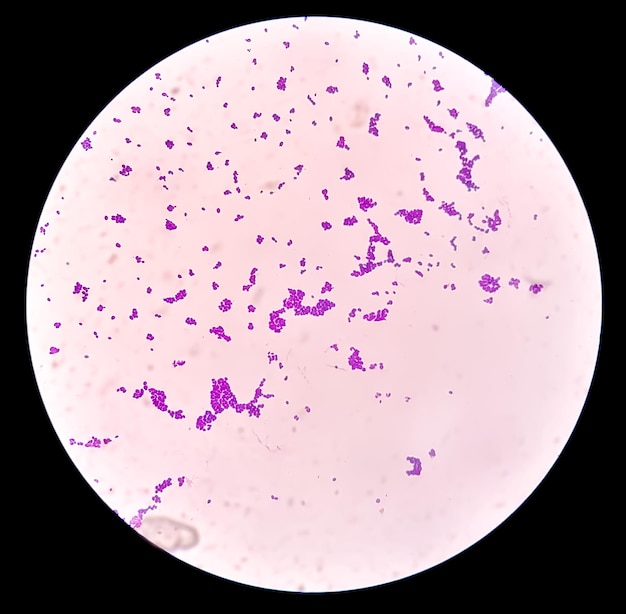 Candida colony under microscopic view or Candida albicans fungus infection