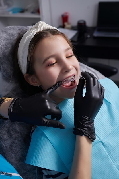 Caucasian little kid girl invisible aligner and pointing to her perfect straight teeth. Dental healthcare and confidence concept.