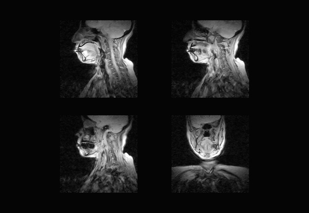 Cervical Spine MRI and ct scan xray images professional