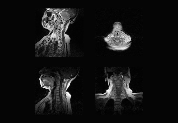 Cervical Spine MRI and ct scan xray images professional