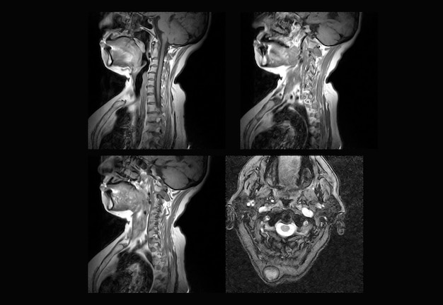 Cervical Spine MRI and ct scan xray images professional