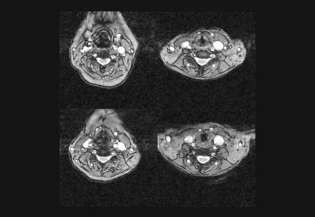 Cervical Spine MRI and ct scan xray images professional