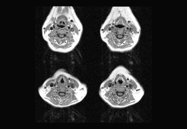 Cervical Spine MRI and ct scan xray images professional