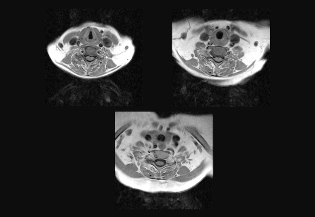 Cervical Spine MRI and ct scan xray images professional