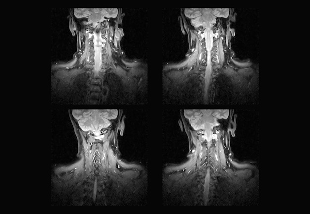 Cervical Spine MRI and ct scan xray images professional