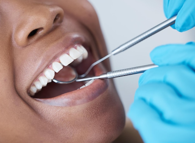 Checkup mouth and woman at the dentist for dental care healthcare and search for cavities Mirror healthy and doctor looking at the teeth of a patient for treatment oral hygiene and surgery