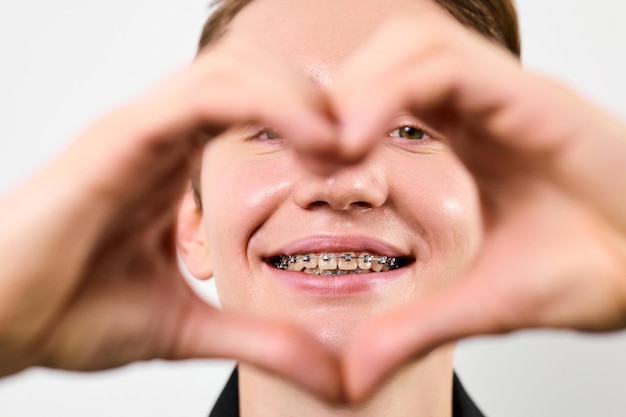 Photo a cheerful man with dental braces is forming a heart shape with their hands which are framed around the face against a white background showcasing a positive and playful expression