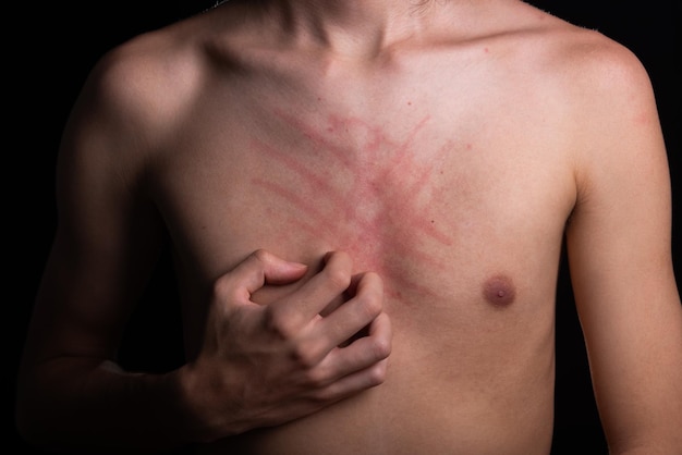 Photo chest of an angry man hand itching skin disease irritation allergy