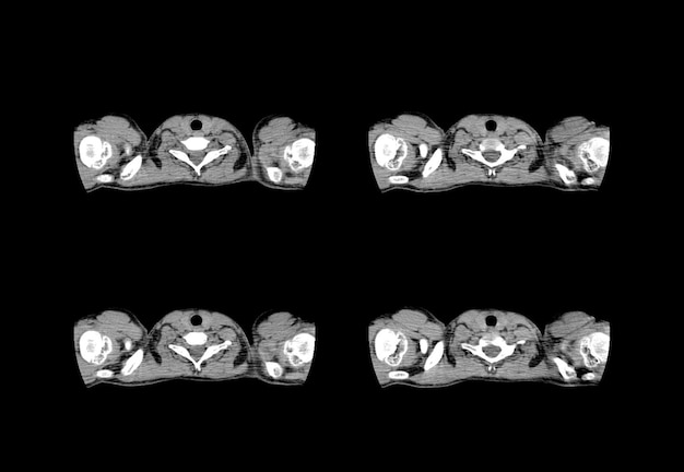 Chest ct scan and MRI creative images