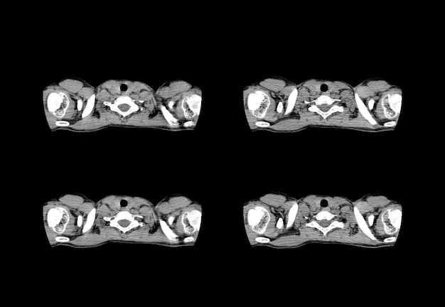 Chest ct scan and MRI creative images