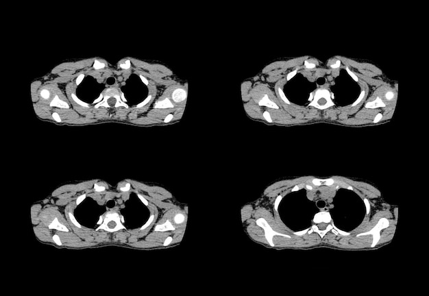 Chest ct scan and MRI creative images