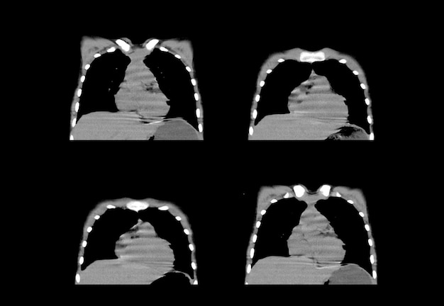 Chest ct scan and MRI creative images