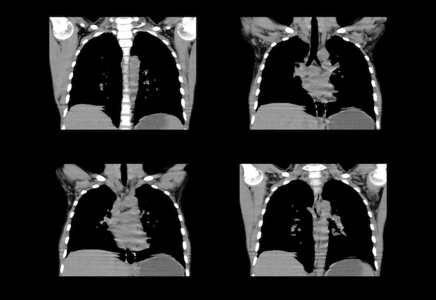 Chest ct scan and MRI creative images