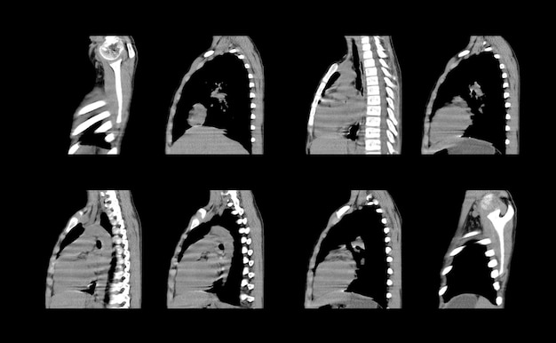 Chest ct scan and MRI creative images