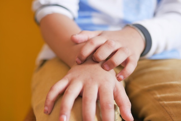 Child girl suffering from itching skin on hand