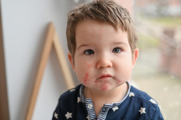 child has a rash on his face from eating