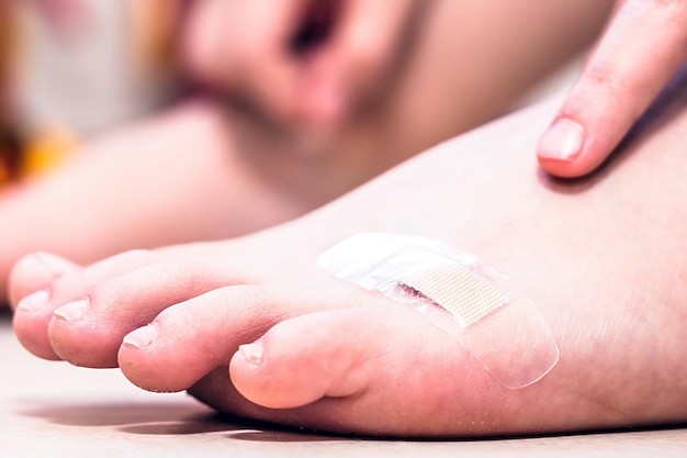 child putting bandage under foot wound band aid over wound with Caucasian child fair skin