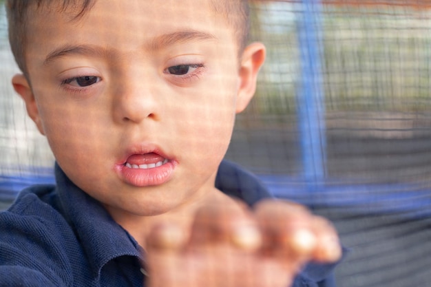 A child with Down syndrome tries to break a net in which he finds himself inside