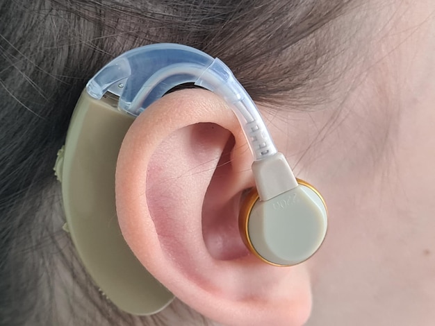 Child with hearing aid and hearing problem