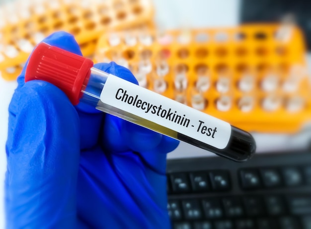 Cholecystokinin, a peptide hormone  which is stimulating the digestion of Fat and Protein.