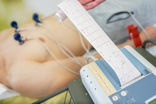 Photo clinical analysis in progress precision cardiac monitoring at a modern healthcare facility