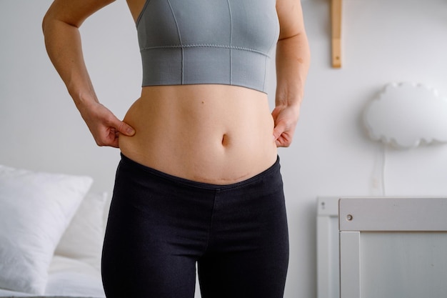 Close up of a belly with scar from csection and side belly fat Women's health A woman dressed up in sportswear demonstrating her imperfect body after a childbirth with nursery on the background