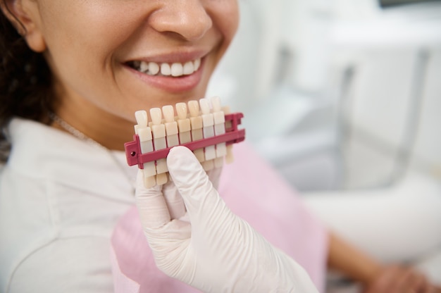 Close-up of dentist's hand holding tooth color chart near the face of patient smiling with beautiful toothy smile. Teeth whitening, bleaching, aesthetic dentistry, oral hygiene and dental care concept