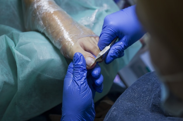 Close up of doctor in gloves making procedure for foot. Pedicure in beauty spa salon.