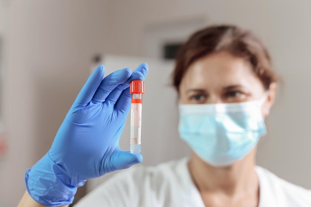 Close up of a doctors hand with a blood test tube in a laboratory